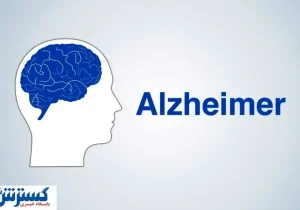 با آزمایش ۳ دقیقه ای آلزایمر را در نطفه خفه کنید !