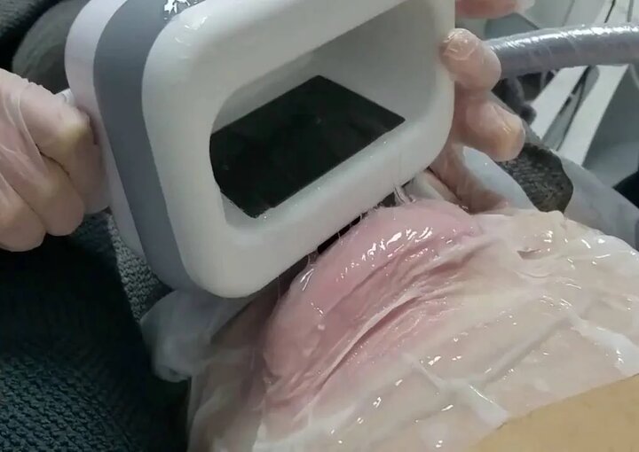 لاغری به هر قیمت؟ از جراحیهای علمی تا دام تبلیغات اینستاگرامی لاغری به هر قیمت؟ از جراحیهای علمی تا دام تبلیغات اینستاگرامی