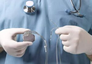 پایان صف انتظار باتریهای قلبی و ICD؛ تأمین تجهیزات برای ۱۲ هزار بیمار