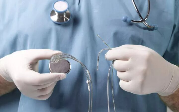 پایان صف انتظار باتریهای قلبی و ICD؛ تأمین تجهیزات برای ۱۲ هزار بیمار